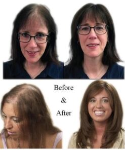 Magic Hair Topper Clip