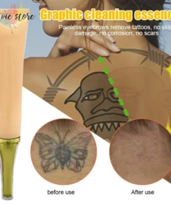 permanent tattoo removal cream