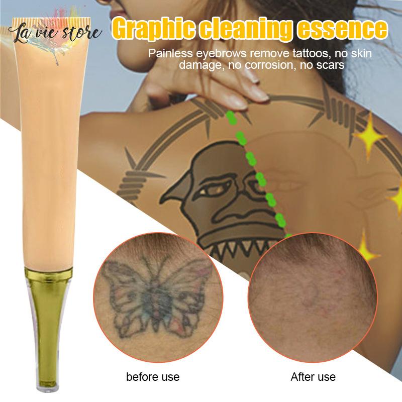 Permanent Tattoo Removal Cream Buy Today Get 75 OFF