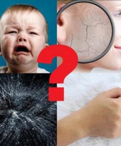 Anti Dust Mite Patch