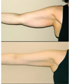 Lymphatic Drainage Ginger Oil