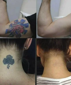 Permanent Tattoo Removal Cream