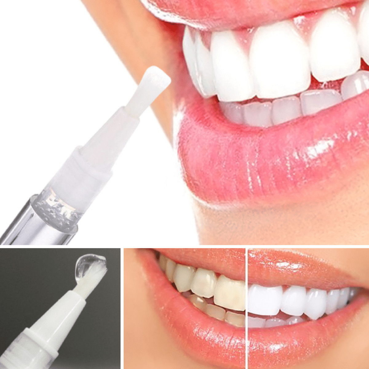 https://www.wowelo.com/wp-content/uploads/2019/11/Teeth_whitening_pen_1024x1024_2x_1024x1024_2x_a64e326c-4141-4927-9114-6afb9d8ade6c.png