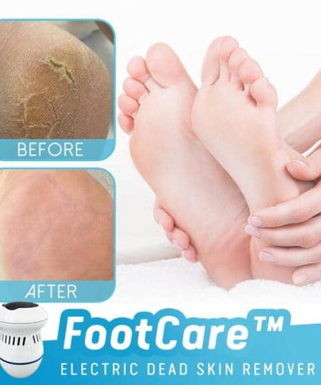 CareFoot™ Electric Dead Skin Remover