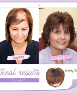 Alternative view of Luxurious Remy Hair Topper