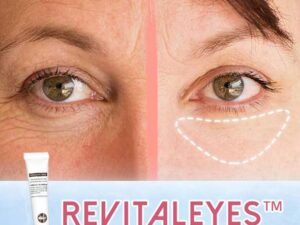 Revitaleyes™ Repair Eye Cream