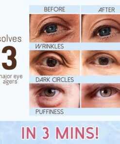 Revitaleyes™ აღმდგენი თვალის კრემი