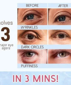 Revitaleyes™ Repair Eye Cream