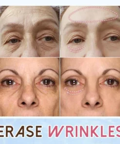 Revitaleyes™ Repair Eye Cream