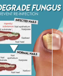ʻO Dotorus™ Fungus Nail Repair Gel