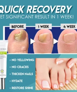 Alternative view of Dotorus™ Fungus Nail Repair Gel