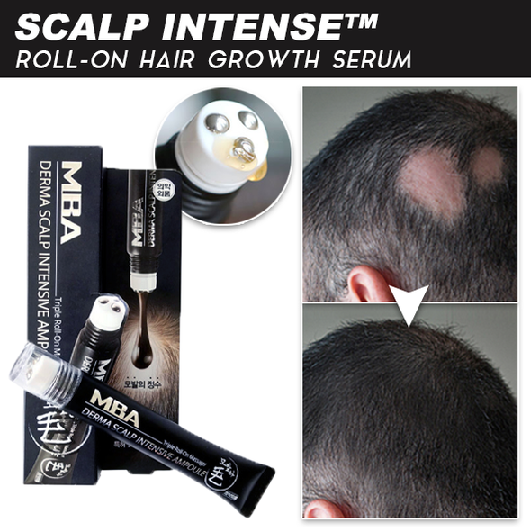 Scalp Intense™ Roll-on Hair Growth Serum