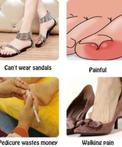 Glue Free Toenail Patch