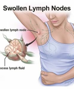 Herbal Natural Lymph Patch