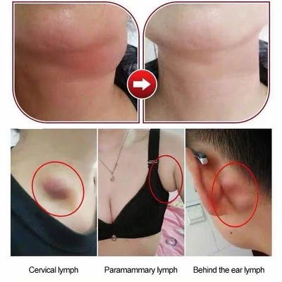 Herbal Natural Lymph Patch