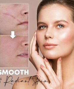 Medease™ Skin Rebound Cream