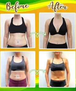 BellyGo™️ Herbal Slimming Waist Pellet