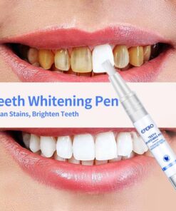 Magical Teeth Whitening Pen