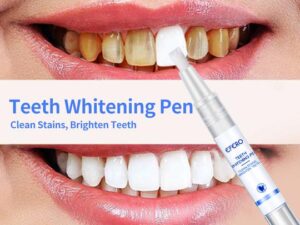 Magical Teeth Whitening Pen