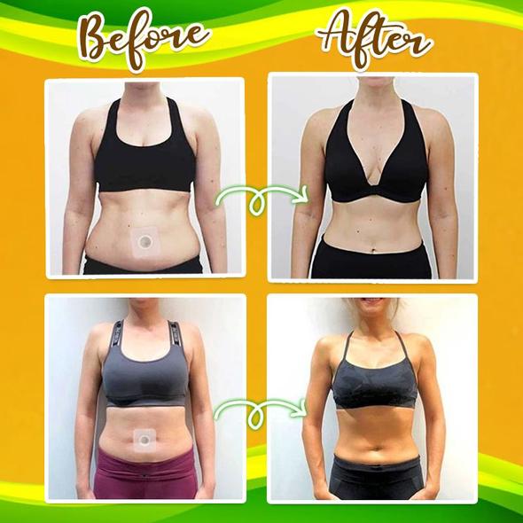 LeanFit™️ Belly Herbal Slimming Pellet (✨50%OFF)