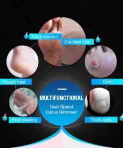 VeetSmoother Vacuum Collector