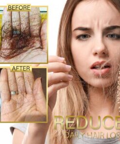 Nutritvio™ Anti-Hairloss Serum