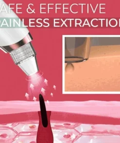 Dermation™ Vacuum Suction Pore Cleanser