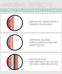 Dermation™ Vacuum Suction Pore Cleanser