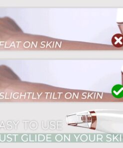 Dermation™ Vacuum Suction Pore Cleanser