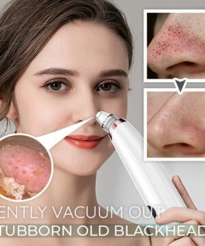 Dermation⢠Vacuum Suction Pore Cleanser