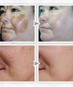 Peelick™ Revitalizing Modeling Mask