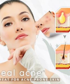 Peelick™ Revitalizing Modeling Mask