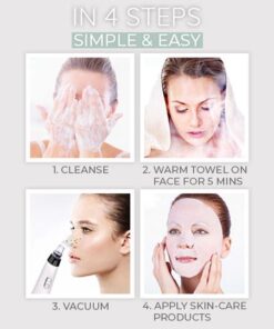 Dermation™ Vacuum Suction Pore Cleanser