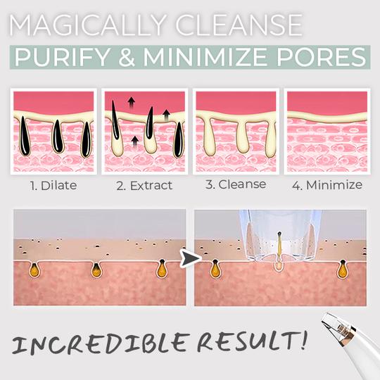 Dermation™ Vacuum Suction Pore Cleanser