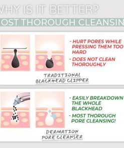 Dermation™ Vacuum Suction Pore Cleanser