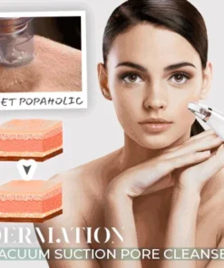 Dermation™ Vacuum Suction Pore Cleanser