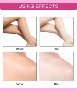 ❤️SPRING DAY FLASH SALE - 50% OFF-- VOVA™ 2021 NEW WHITENING CREAM