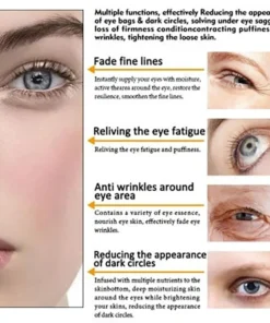 50%OFF--2021 NEW Magic Eye Cream-Buy 1 Get 1 Free