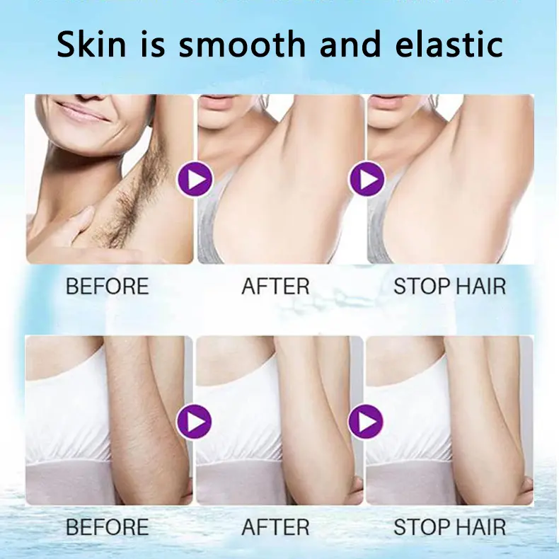 (🔥Hot Summer Sale - 50% OFF)2021 Magical Hair Inhibitor & Hair Removal💝BUY 1 GET 1 FREE!!