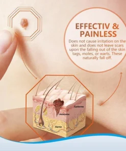 Instant Blemish Removal Gel(Limited Time Discount 🔥 Last Day)