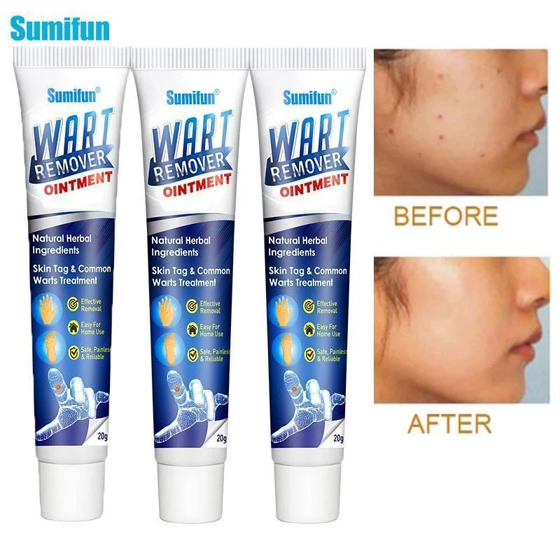 Instant Blemish Removal Gel(Limited Time Discount 🔥 Last Day)