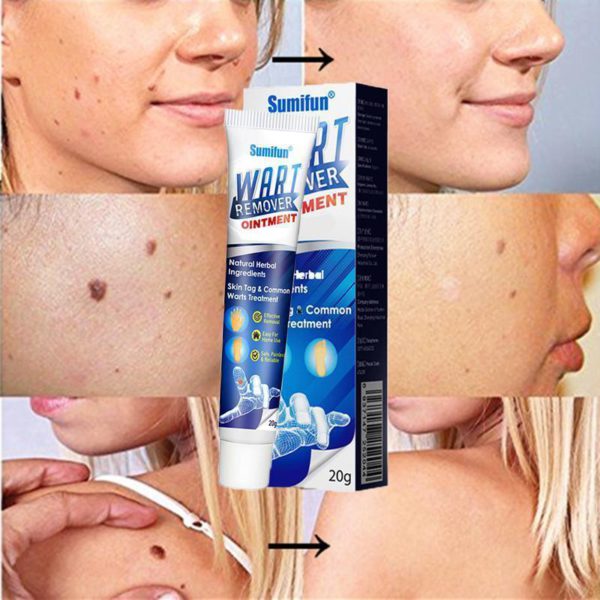 Instant Blemish Removal Gel（Limited Time Discount 🔥 Last Day）