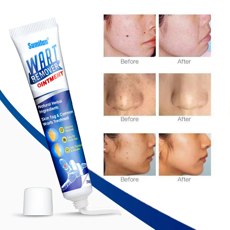Instant Blemish Removal Gel🔥Buy 1 Get 1 Free