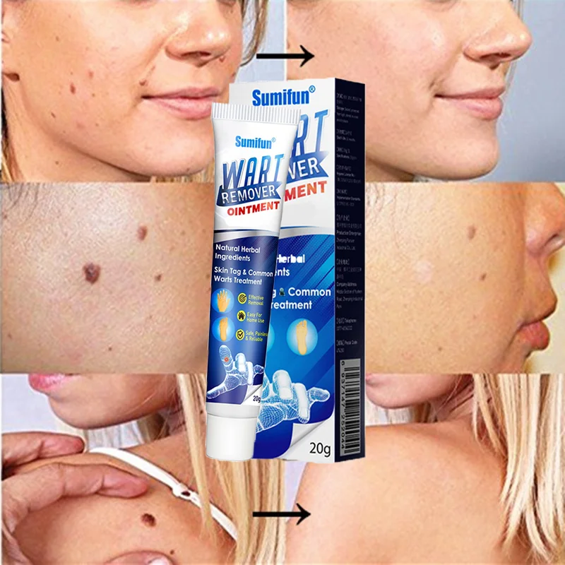 Instant Blemish Removal Gel🔥Buy 1 Get 1 Free