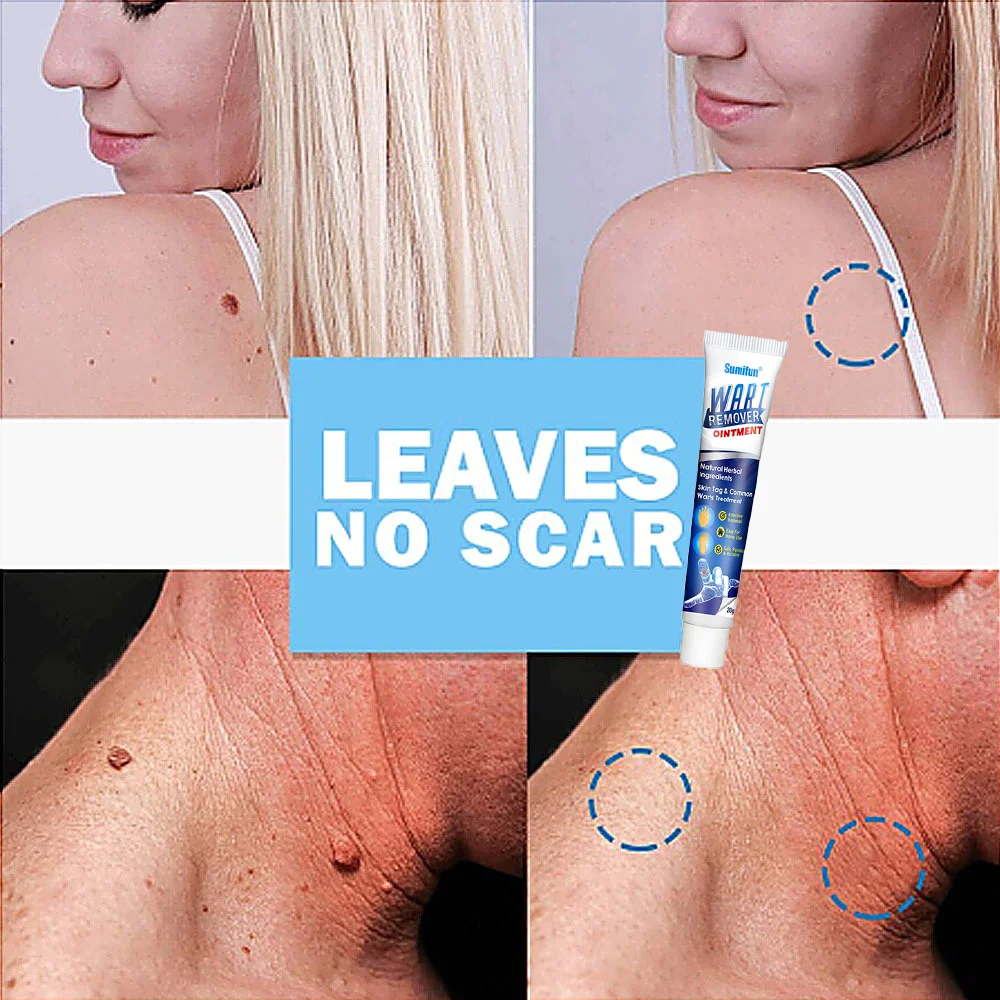 Instant Blemish Removal Gel🔥Buy 1 Get 1 Free