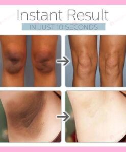 ❤️SPRING DAY FLASH SALE - 50% OFF-- VOVA™ 2021 NEW WHITENING CREAM