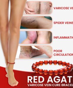 Red Agate Varicose Vein Cure Anklet