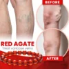 Red Agate Varicose Vein Cure Anklet