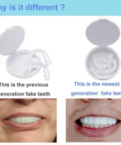 🔥50% OFF🔥 Magic Smile Teeth Brace 💝BUY 1 GET 1 FREE!