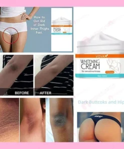 ❤️SPRING DAY FLASH SALE - 50% OFF-- VOVA™ 2021 NEW WHITENING CREAM